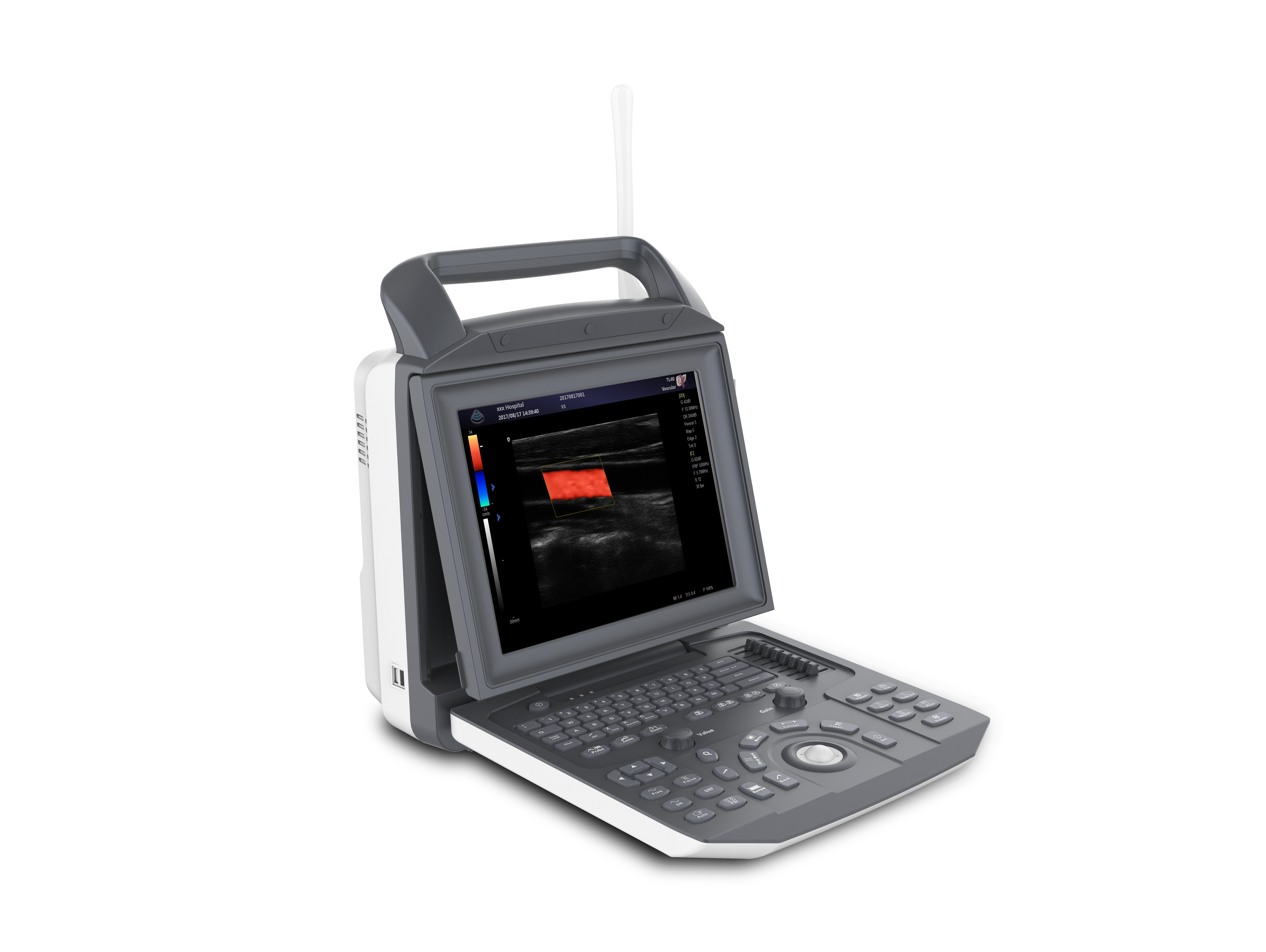 Cardio Técnica — Zoncare M5 Vet